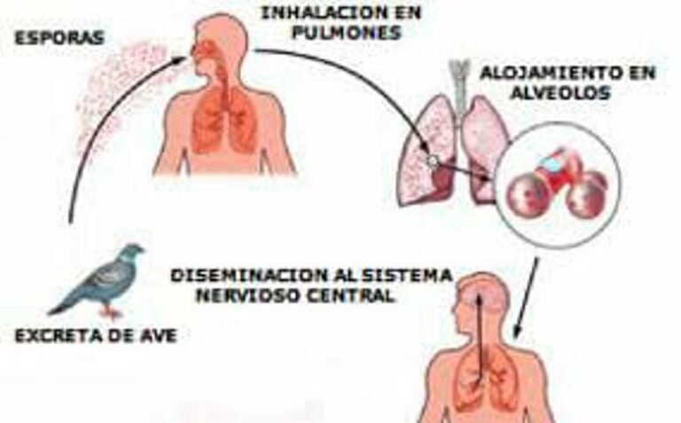 Se pide estar atentos ante posibles casos de psitacosis